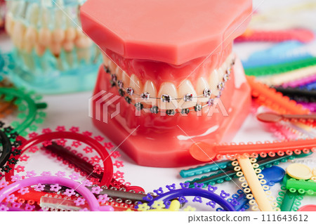 Orthodontic ligatures rings and ties, elastic rubber bands on orthodontic braces, model for dentist studying about dentistry. 111643612