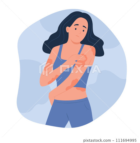 Woman Looking Eczema on Body for Dermatology Concept Illustration 111694995