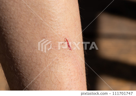 Bruised wound injury with blood bleeding on woman leg background 111701747