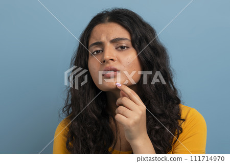 Stressed sad brunette young woman touching her face 111714970