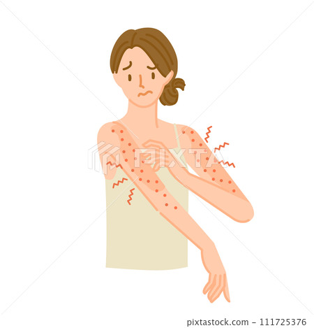 A woman whose arm skin is rough, inflamed, and itchy due to an allergic reaction. 111725376