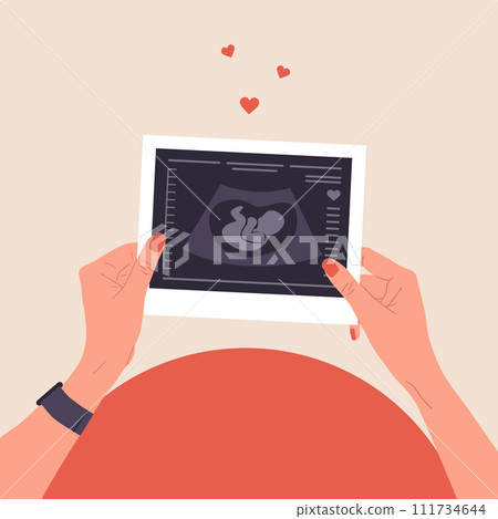 Ultrasound of baby. Female hands holding fetus silhouette photo. Embryo in womb. Pregnancy belly top view. Baby health diagnostic. Sonography or ultrasonography concept. Cartoon vector illustration 111734644