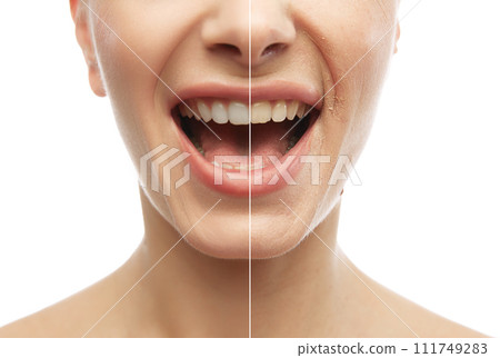 Oral care and hygiene. Half-face comparison with smile showing healthy and white teeth. Collage. Concept of natural beauty and medicine Oral care and hygiene. Half-face comparison with smile showing healthy and white teeth. Collage. Concept of natural beauty and medicine 111749283