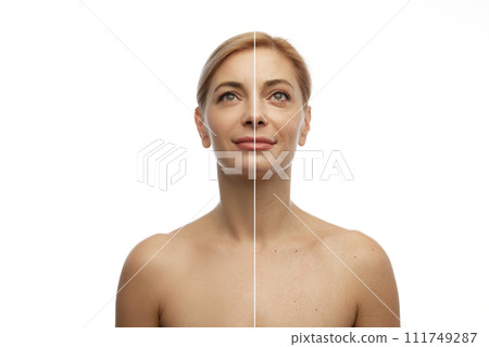 Before-and-after skincare treatment. Half-face comparison of pretty young woman with clear skin contrast. Anti-aging spa procedures. Before-and-after skincare treatment. Half-face comparison of pretty young woman with clear skin contrast. Anti-aging spa procedures. 111749287