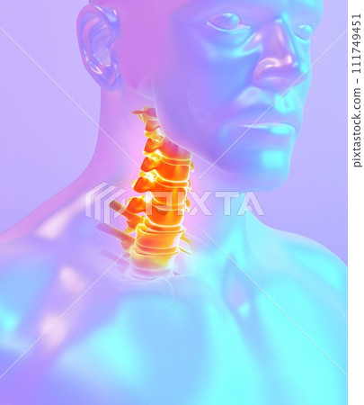 Neck painful skeleton x-ray, 3D illustration. 111749451