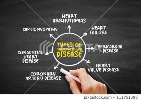 Types of cardiovascular disease (group of disorders of the heart and blood vessels) mind map text concept for presentations and reports 111751390