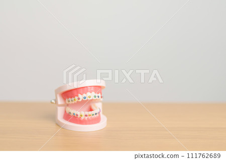 Orthodontic tooth model and bracket or brace. Clean and Scrape off tartar. May Orthodontic Health Day, March Oral health, Dentist Day, False Teeth. Toothache and Children Dental Health Orthodontic tooth model and bracket or brace. Clean and Scrape off tartar. May Orthodontic Health Day, March Oral health, Dentist Day, False Teeth. Toothache and Children Dental Health 111762689