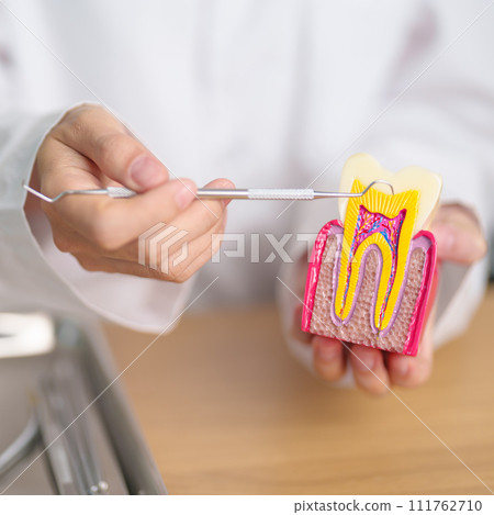 Dentist with tooth Anatomy model. Oral Teeth decay and disease, Scrape off tartar. March Oral health, Dentist Day, False Teeth. Toothache and Children Dental Health Month and Orthodontic Health Day 111762710