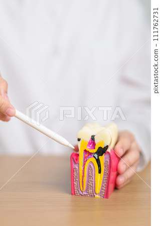 Dentist with tooth Anatomy model. Oral Teeth decay and disease, Scrape off tartar. March Oral health, Dentist Day, False Teeth. Toothache and Children Dental Health Month and Orthodontic Health Day Dentist with tooth Anatomy model. Oral Teeth decay and disease, Scrape off tartar. March Oral health, Dentist Day, False Teeth. Toothache and Children Dental Health Month and Orthodontic Health Day 111762731