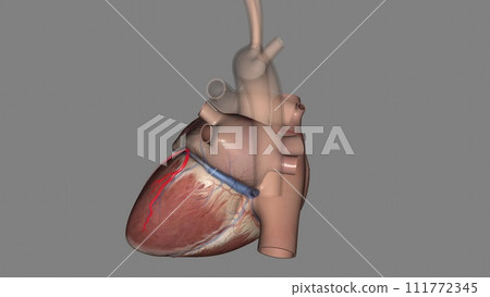 The circumflex branch of left coronary artery is a branch of the left coronary artery The circumflex branch of left coronary artery is a branch of the left coronary artery 111772345