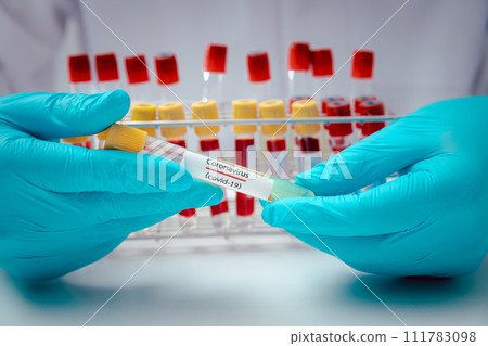 Test tubes containing plasma extracted from the blood of people who had been ill with coronavirus, COVID-19. For use in making medicines or vaccines. 111783098