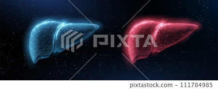 Normal and red liver. Fatty liver, Bile detox, Nash disease 111784985