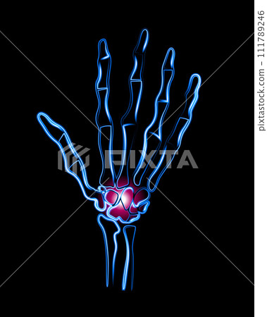Vector isolated illustration of wrist pain. Hand with localization of pain in the wrist. 111789246