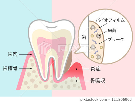 biofilm and healthy teeth biofilm and healthy teeth 111806903