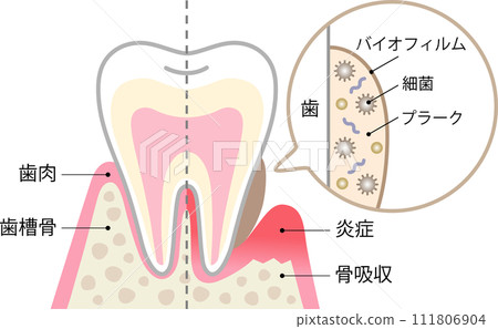 biofilm and healthy teeth biofilm and healthy teeth 111806904