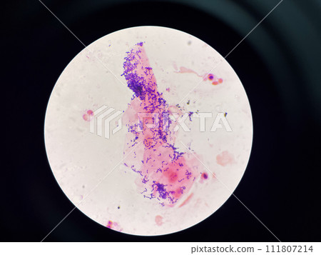 Gram positive bacilli 111807214