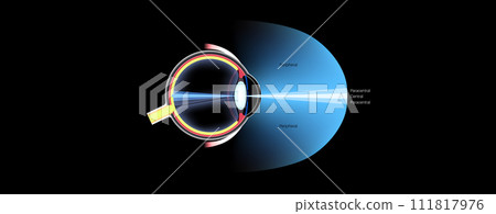 Peripheral vision poster Peripheral vision poster 111817976