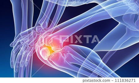 Visual representation of knee pain: An image that embodies pain and discomfort in the room bar area.<AI-generated material> Visual representation of knee pain: An image that embodies pain and discomfort in the room bar area.<AI-generated material> 111836271