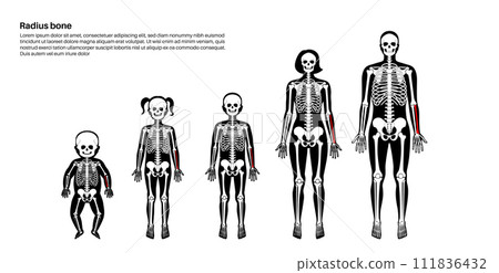 Radius bone anatomy 111836432