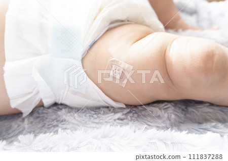 Image of the base of the baby's right foot after vaccination 111837288