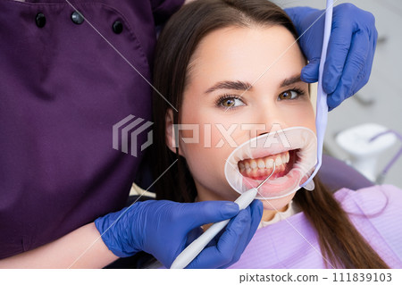 Close up of beautiful female smile with white teeth during medical examination 111839103