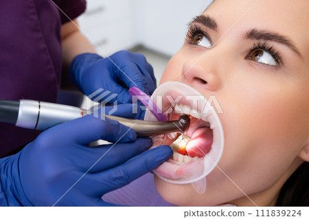 Proficient female dentist in gloves removes damaged part of tooth with dental drill. Cavities treatment process in private dental clinic Proficient female dentist in gloves removes damaged part of tooth with dental drill. Cavities treatment process in private dental clinic 111839224