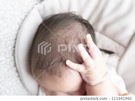 Baby with scratches on scalp from scratching too much 111841992