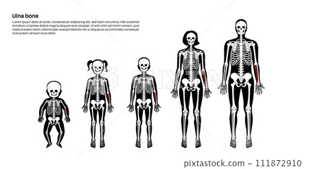 Ulna bone anatomy Ulna bone anatomy 111872910