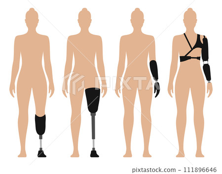 Woman with prosthetic arm and leg, medical vector illustration set, isolated on white background 111896646