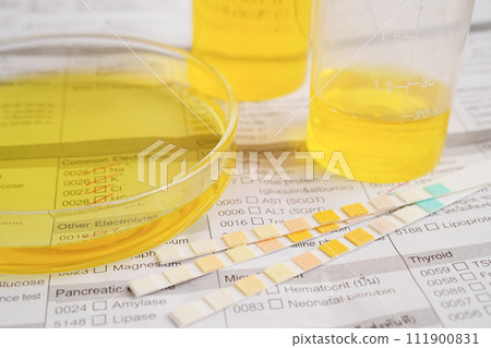 Urinalysis, urine cup with reagent strip pH paper test and comparison chart in laboratory. 111900831
