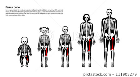 Femur bone anatomy Femur bone anatomy 111905279