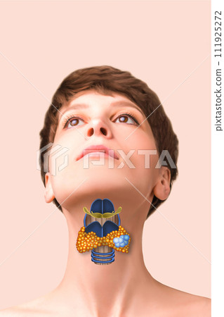Medical concept. Abstract female with enlarged thyroid gland Medical concept. Abstract female with enlarged thyroid gland 111925272