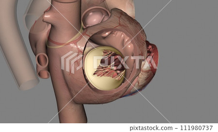 The tricuspid valve sits between the heart's two right chambers The tricuspid valve sits between the heart's two right chambers 111980737