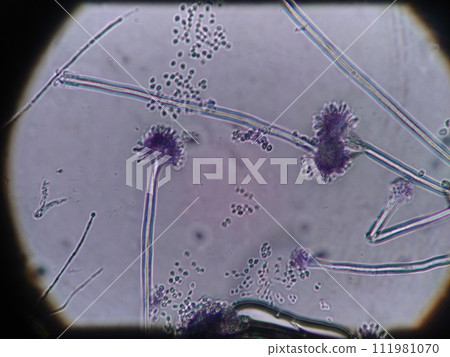 Aspergillus mold with small spores popping out Aspergillus mold with small spores popping out 111981070