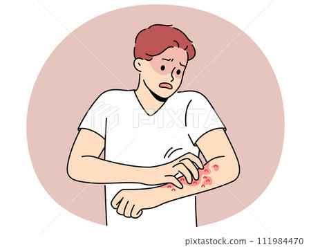 Unhealthy man scratch redness on arms Unhealthy man scratch redness on arms 111984470