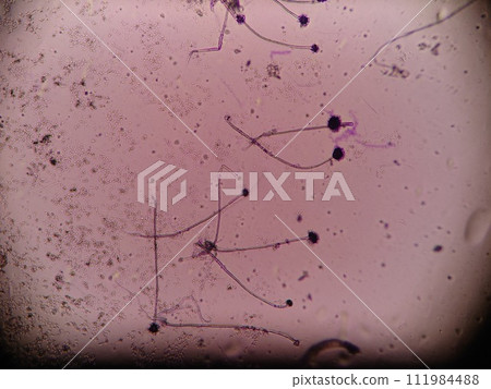 黴菌孢子的顯微照片 111984488