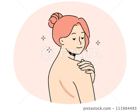 Naked woman show scar on back 111984493