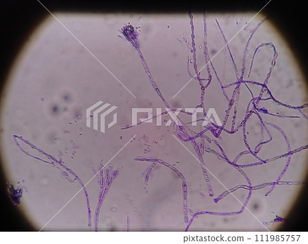菌絲長得有多細 111985757