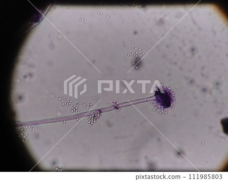 長黴菌菌絲和孢子 長黴菌菌絲和孢子 111985803