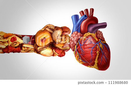 Unhealthy Eating Heart Attack 111988680