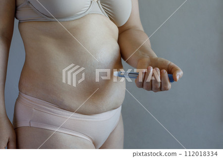 Self injection. Woman with injection pen close up. Medicine and treatment concept 112018334