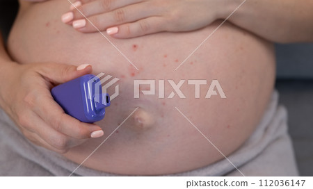 A pregnant woman smokes a vape while sitting on the couch. Close-up of the belly with allergies. A pregnant woman smokes a vape while sitting on the couch. Close-up of the belly with allergies. 112036147