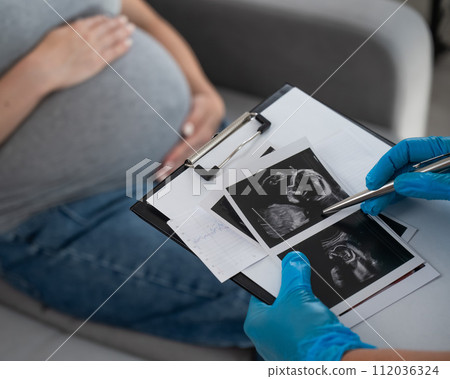 Gynecologist looks at an ultrasound of a pregnant woman. Gynecologist looks at an ultrasound of a pregnant woman. 112036324