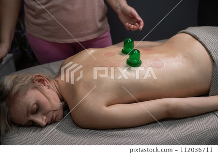 A woman undergoing a massage using vacuum plastic jars. 112036711