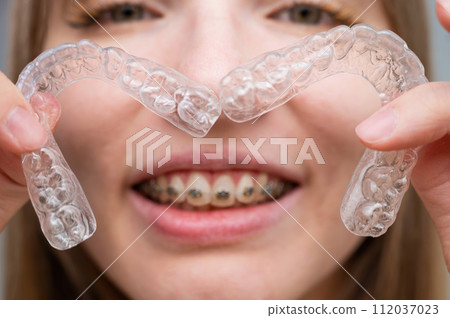 Woman with braces on her teeth holding and removable transparent aligners.  112037023