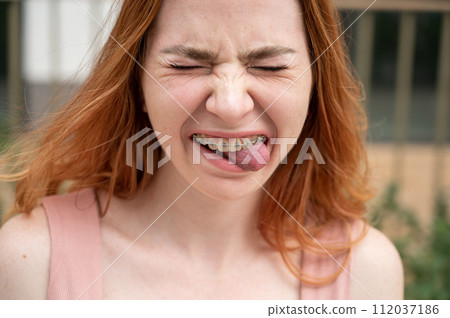 Young woman with braces on her teeth smiles and shows her tongue outdoors.  112037186