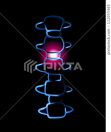 Vector isolated illustration of cervical vertebrae. Neon contour drawing of the cervical spine. Neck pain. Displacement of the vertebrae. Vector isolated illustration of cervical vertebrae. Neon contour drawing of the cervical spine. Neck pain. Displacement of the vertebrae. 112055985