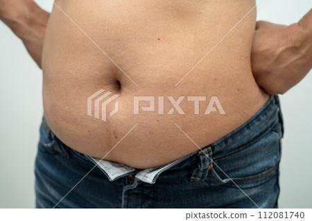 Overweight Asian woman show and use hand to squeeze fat belly. Overweight Asian woman show and use hand to squeeze fat belly. 112081740