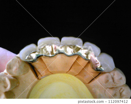 混合樹脂牙齒模型/Estenia Angle 從舌側看 112097412