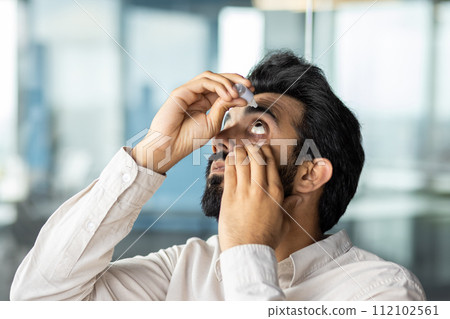 Close-up photo of an Indian young business man working in the office, applying medical drops to his eyes from fatigue and pain. Close-up photo of an Indian young business man working in the office, applying medical drops to his eyes from fatigue and pain. 112102561